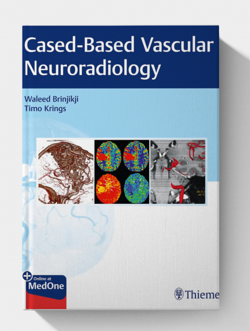 Imaging in Neurovascular Disease: A Case-Based Approach (1st Edition)