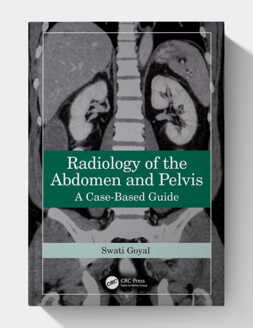 Radiology of the Abdomen and Pelvis: A Case-Based Guide (1st Edition) 2024