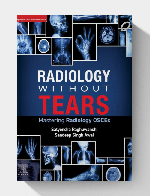 Radiology Without Tears: Mastering Radiology OSCEs  2024 EPUB