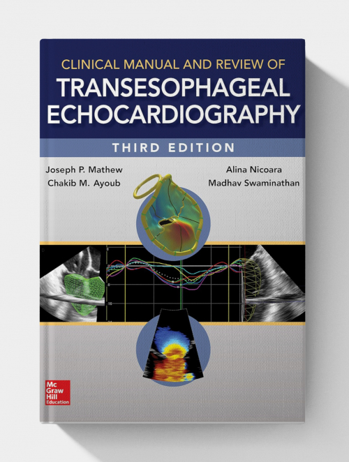 Clinical Manual and Review of Transesophageal Echocardiography (3rd Edition)
