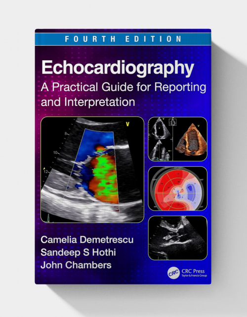 Echocardiography: A Practical Guide for Reporting and Interpretation (4th Edition)