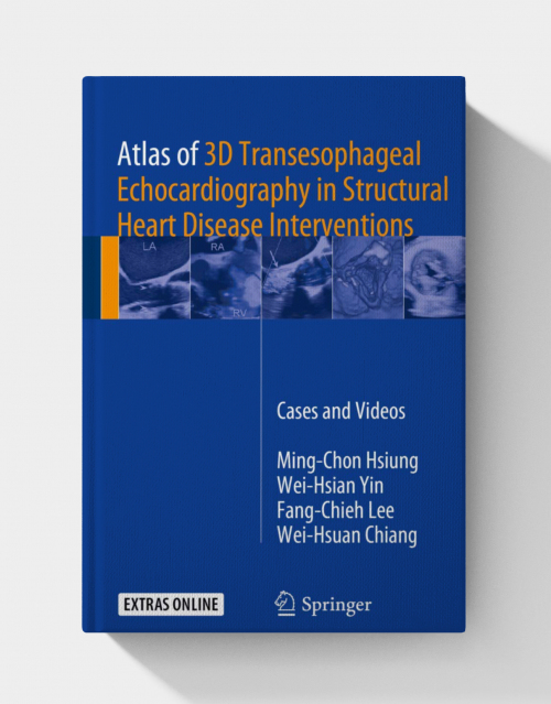 Atlas of 3D Transesophageal Echocardiography in Structural Heart Disease Interventions PDF ONLY