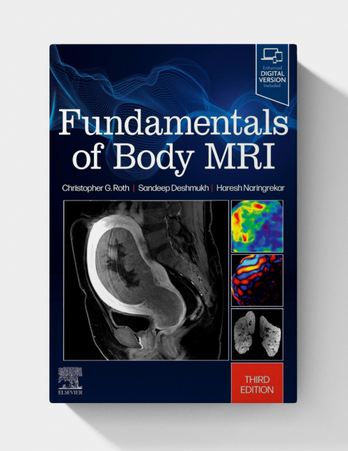 Fundamentals of Body MRI (Fundamentals of Radiology), 3rd edition 2024