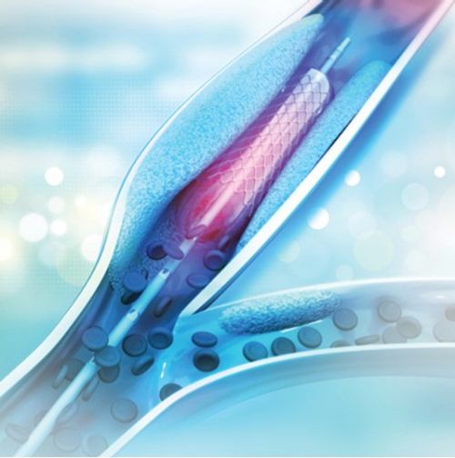 Comprehensive Review and" Update of What’s New in Vascular and Endovascular Surgery 2023 (Videos)