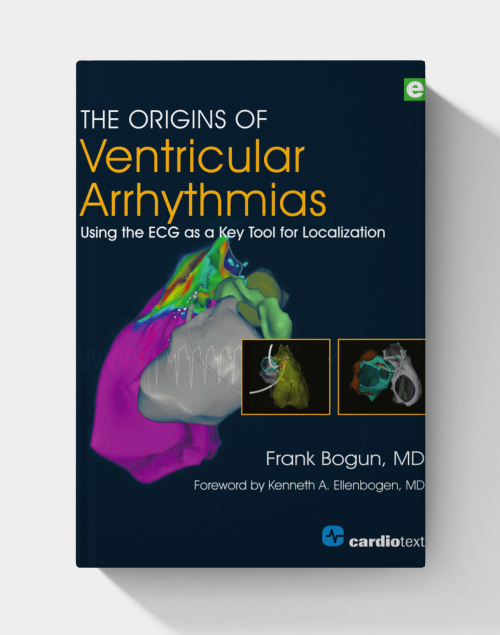 The Origins of Ventricular Arrhythmias Using the ECG as a Key Tool for Localization Volume 1