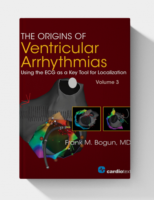 The Origins of Ventricular Arrhythmias: Using the ECG as a Key Tool for Localization, Volume 3