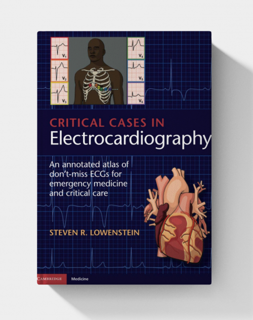 Critical Cases in Electrocardiography: An Annotated Atlas of Don't-Miss ECGs for Emergency Medicine and Critical Care