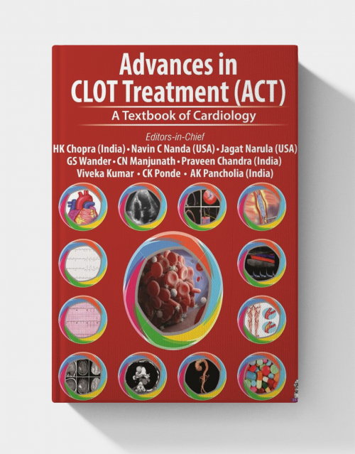 Advances in CLOT Treatment (ACT): A Textbook of Cardiology