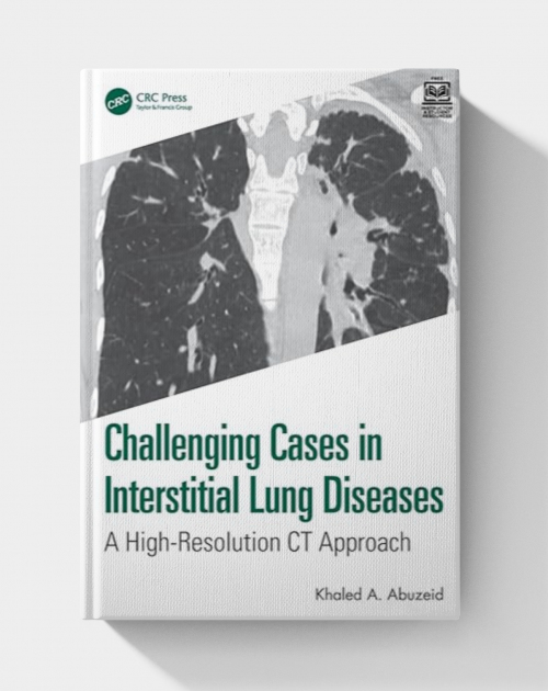 Challenging Cases in Interstitial Lung Diseases: A High-Resolution CT Approach Paperback  (2025)