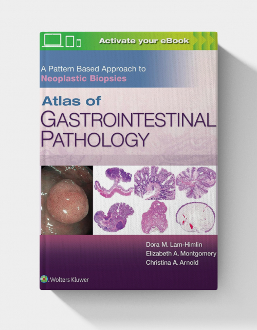 Atlas of Gastrointestinal Pathology: A Pattern Based Approach to Neoplastic Biopsies (1st Edition) EPUB