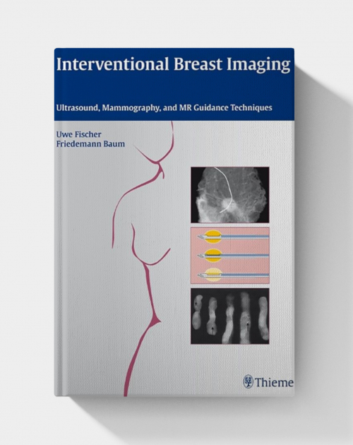 Interventional Breast Imaging : Ultrasound, Mammography, And Mr Guidance Techniques