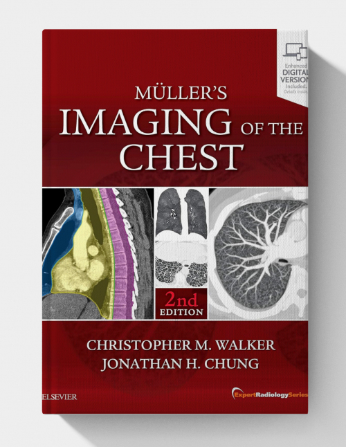 Muller's Imaging of the Chest: Expert Radiology Series (2nd Edition)