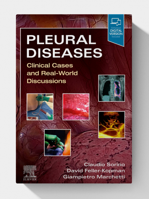 Pleural Diseases: Clinical Cases and Real-World Discussions (1st Edition)