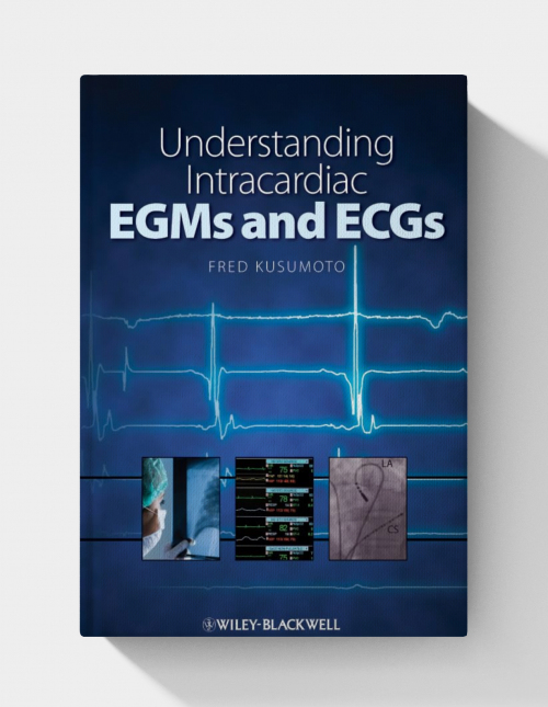 Understanding Intracardiac EGMs and ECGs (1st Edition)