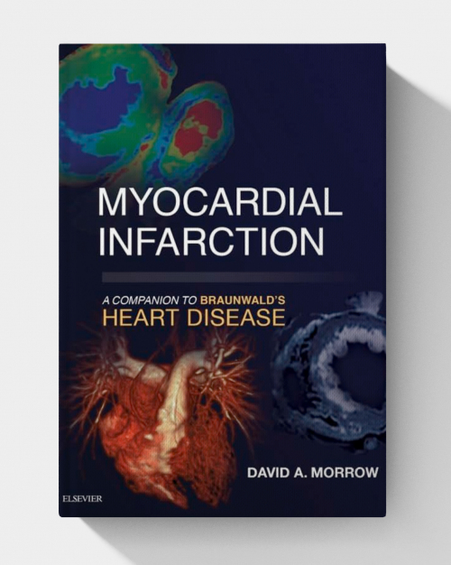 Myocardial infarction : a companion to Braunwald’s heart disease.