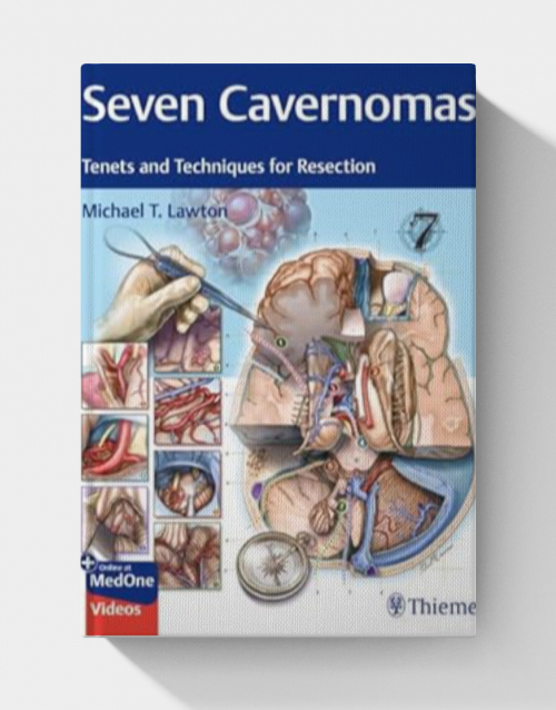 Seven Cavernomas: Tenets and Techniques for Resection