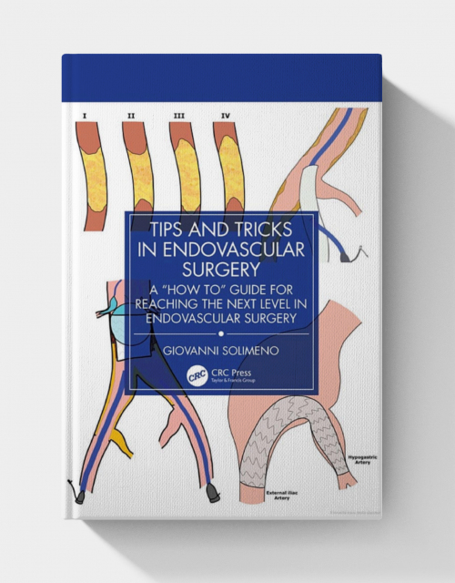 Tips and Tricks in Endovascular Surgery: A “How to” Guide for reaching the next Level in Endovascular Surgery