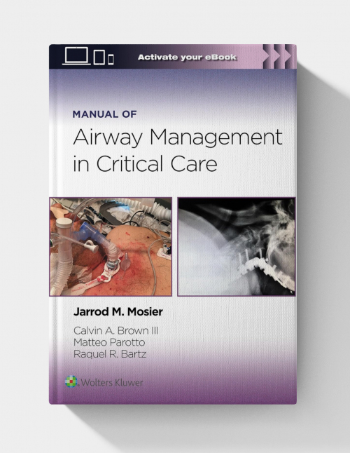 Manual of Airway Management in Critical Care Manual of Airway Management in Critical Care (EPUB+Videos)