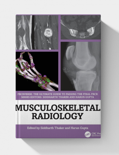 Musculoskeletal Radiology: An Ultimate Guide to Passing the Final FRCR (FRCRverse)
