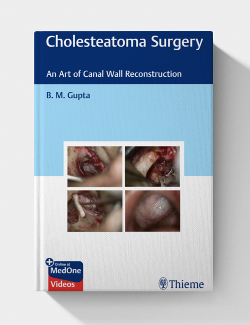 Cholesteatoma Surgery: An Art of Canal Wall Reconstruction