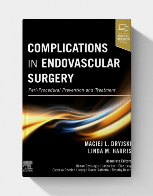Complications in Endovascular Surgery: Peri-Procedural Prevention and Treatment (1st Edition)