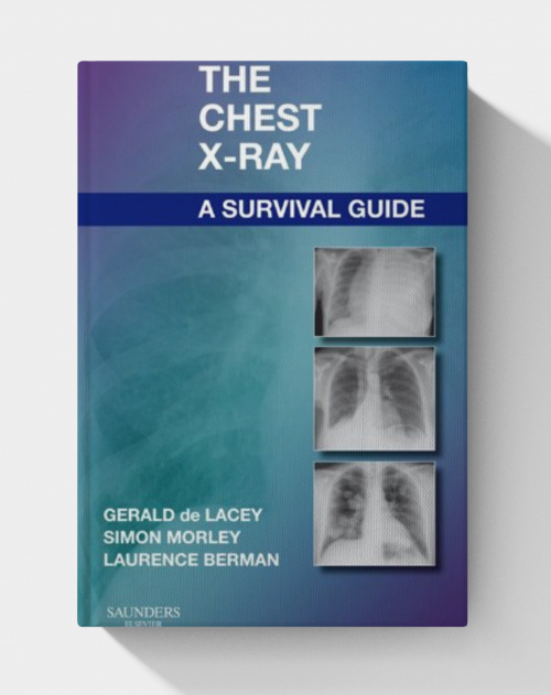 The Chest X-Ray: A Survival Guide (1st Edition)