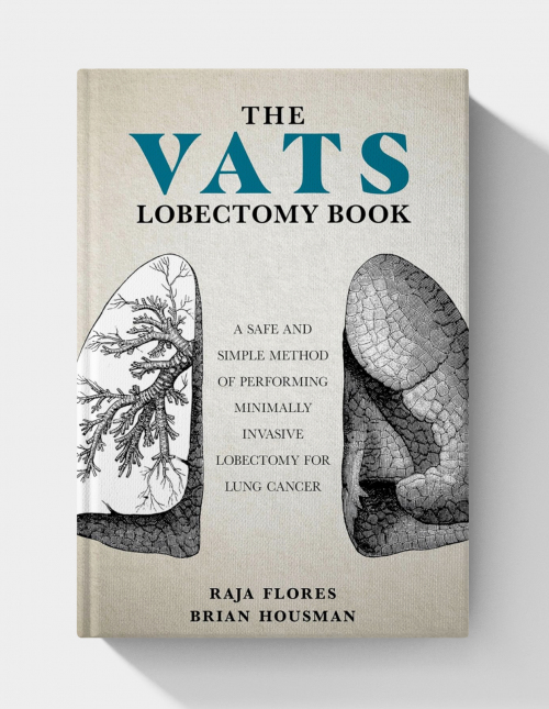 The VATS Lobectomy Book: A Safe and Simple Method of Performing Minimally Invasive Lobectomy for Lung Cancer