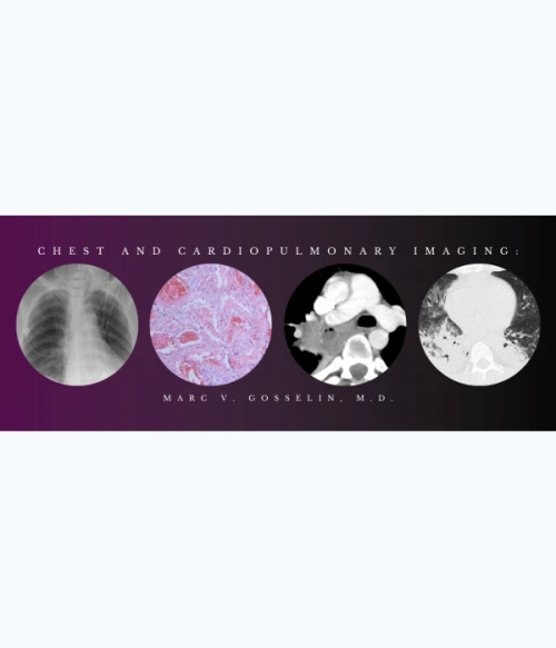 CMEScience Chest and Cardiopulmonary Imaging – Marc V. Gosselin, M.D (Videos + PDF)