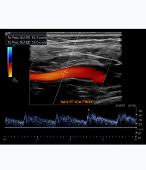 Society for Vascular Medicine Comprehensive Review of Vascular Ultrasound Interpretation and Registry Preparation 2023