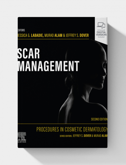 Procedures in Cosmetic Dermatology: Scar Management  (2nd Edition)