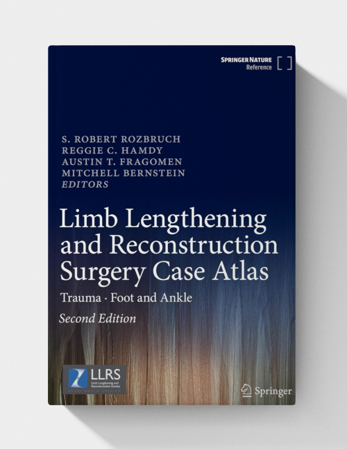Limb Lengthening and Reconstruction Surgery Case Atlas: Trauma • Foot and Ankle  (2nd Edition)