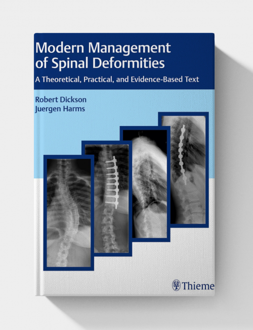 Modern Management of Spinal Deformities  (1st Edition)