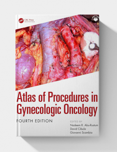 Atlas of Procedures in Gynecologic Oncology (4th Edition) 2026