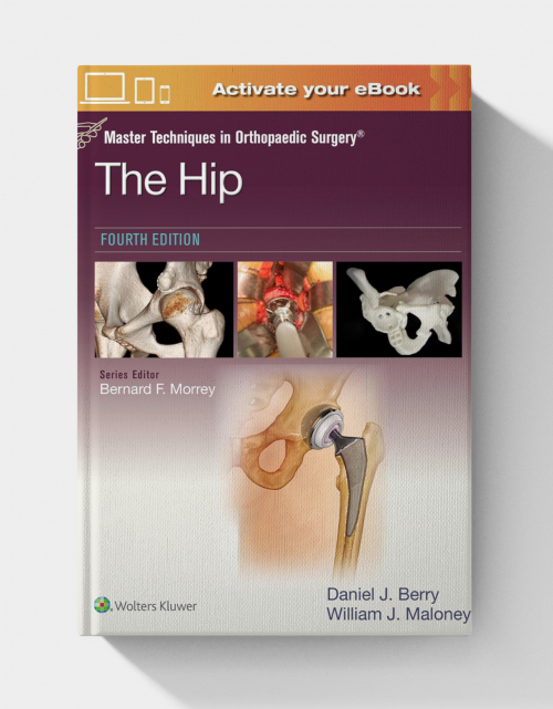 Master Techniques in Orthopaedic Surgery: The Hip  (4th Edition) EPUB+VIDEOS