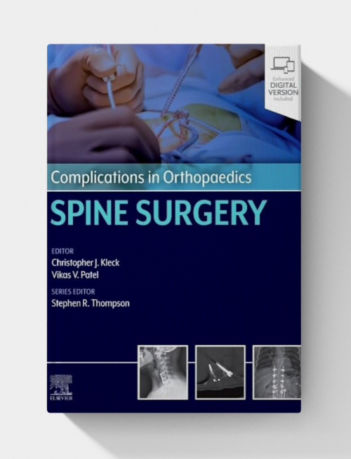 Complications in Orthopaedics: Spine Surgery