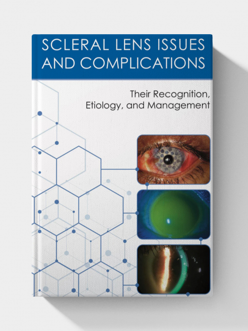 Scleral Lens Issues and Complications