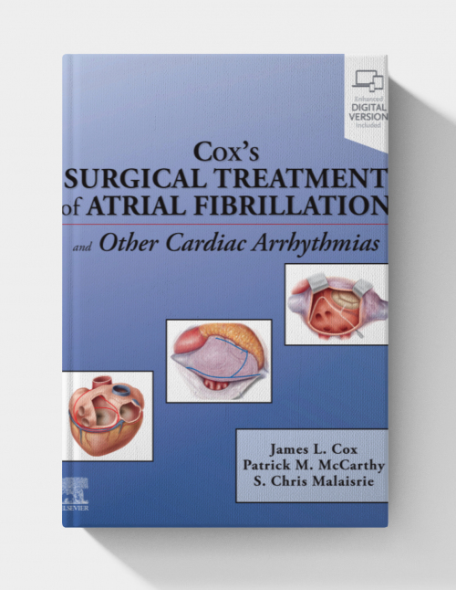 Cox’s Surgical Treatment of Atrial Fibrillation (EPUB)