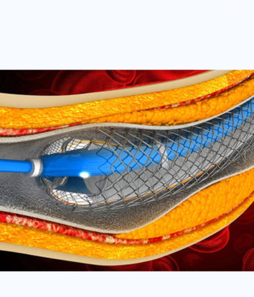 Oakstone Comprehensive Review and Update of What’s New in Vascular and Endovascular Surgery 2025