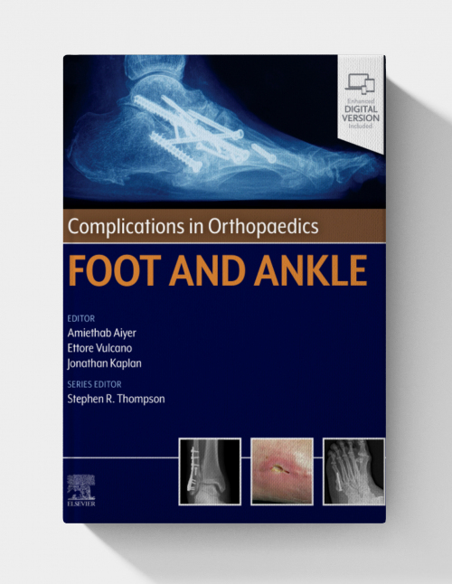 Complications in Orthopaedics: Foot and Ankle (EPUB)