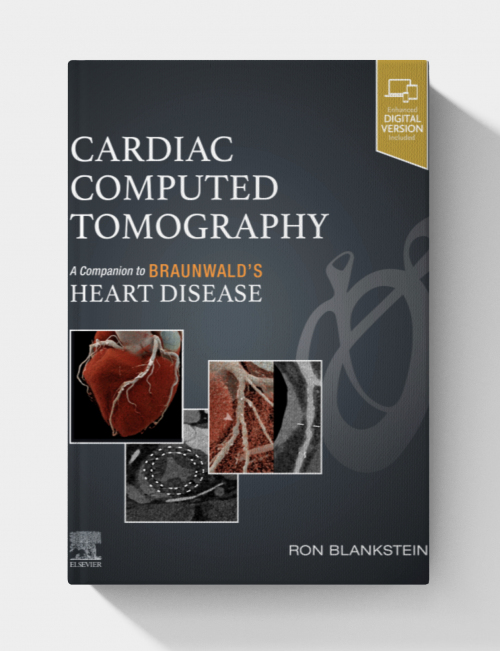 Cardiac Computed Tomography: A Companion to Braunwald’s Heart Disease (EPUB)
