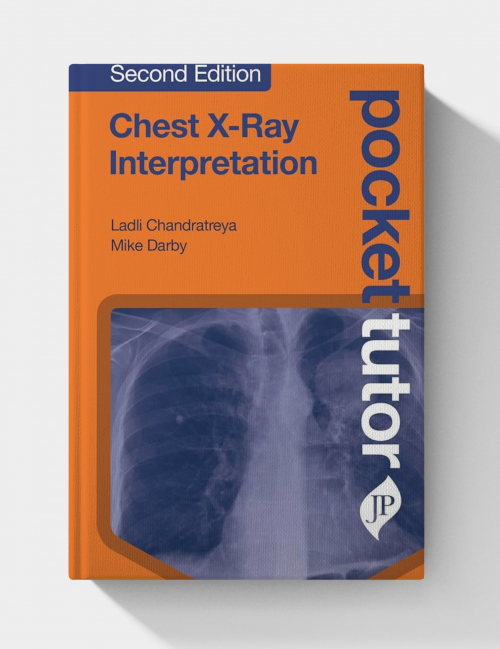 Pocket Tutor: Chest X-Ray Interpretation  (2nd Edition)
