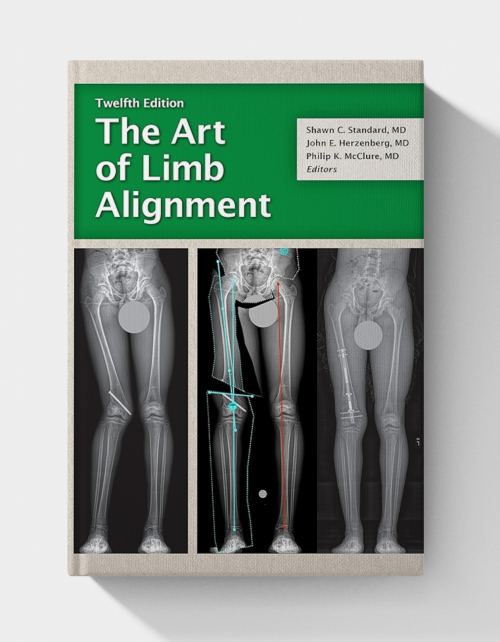 The Art of Limb Alignment  (12th edition)