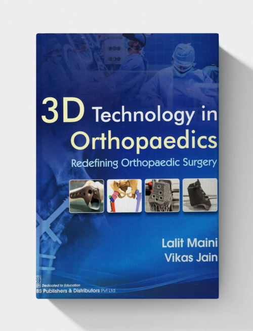3D Technology in Orthopedics