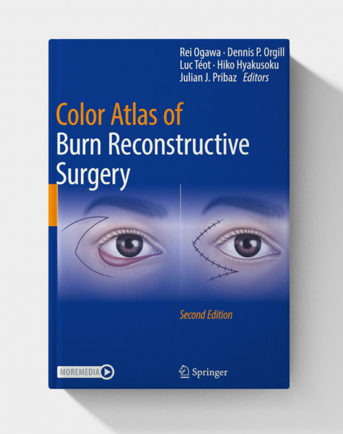 Color Atlas of Burn Reconstructive Surgery (2nd Edition)