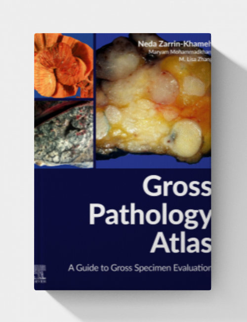 Gross Pathology Atlas: A Guide to Gross Specimens Evaluation
