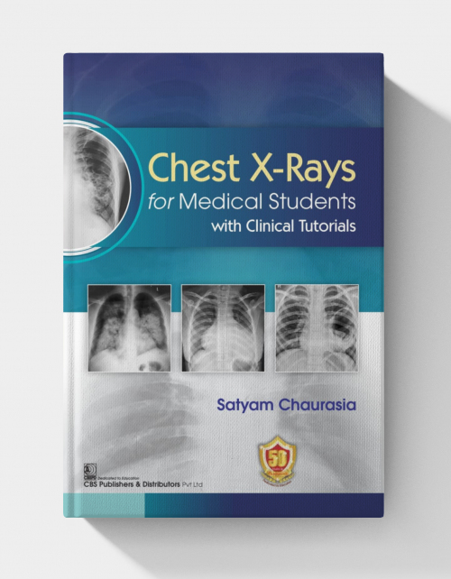 Chest X-ray for Medical Students with Clinical Tutorials