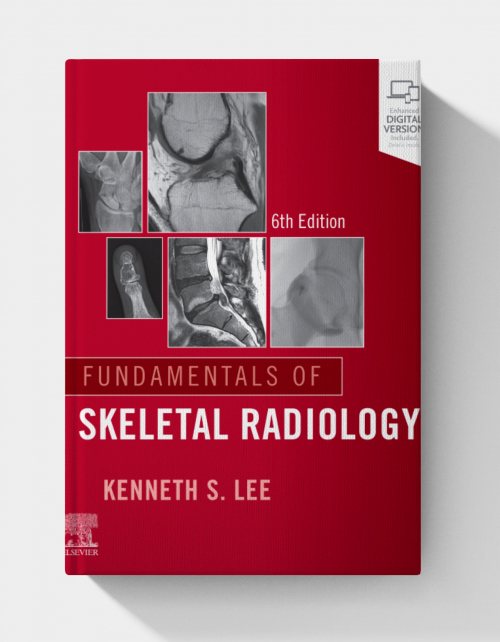 Fundamentals of Skeletal Radiology, 6th edition (True PDF)