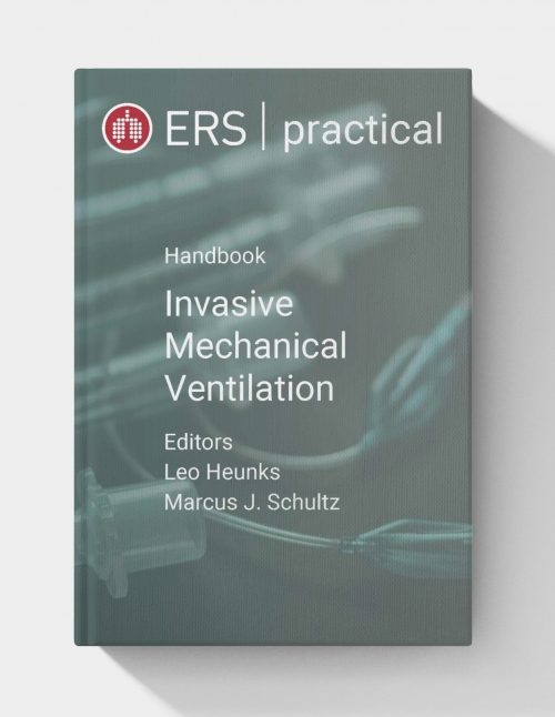 ERS Practical Handbook of Invasive Mechanical Ventilation  (2nd edition)