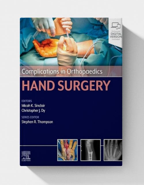 Complications in Orthopaedics: Hand Surgery