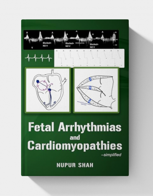 Fetal Arrhythmias and Cardiomyopathies – simplified